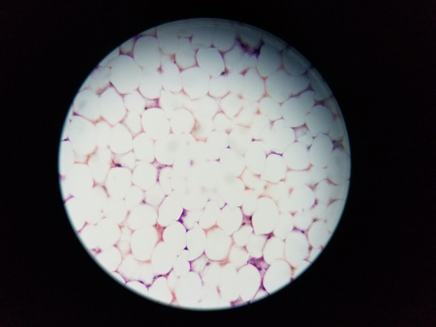 Adipose Connective Slides - Adipose Connective 06 400X